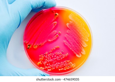 Escherichia Coli Colonies Test On Blood Stock Photo (Edit Now) 526210333