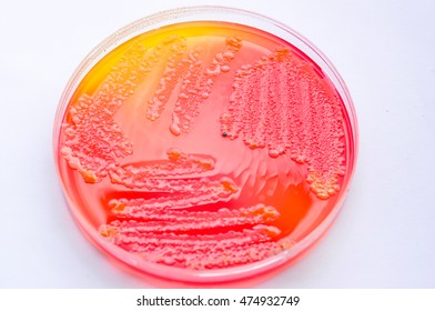 Bordetella Bronchiseptica Colony Morphology On Blood Stock Photo (Edit ...