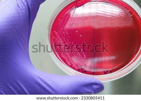 Colonies of Salmonella Typhimurium on XLD agar (Xylose Lysine Deoxycholate agar)