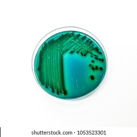 Colonies Of Vibrio Parahaemolyticus on  Thiosulfate-citrate-bile Salts-sucrose Agar  (TCBS)