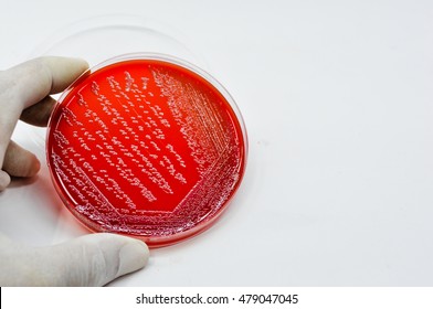 Colonies of White bacteria culture on Blood agar plate close up contains small light grains in experimental laboratory  Hospital white background