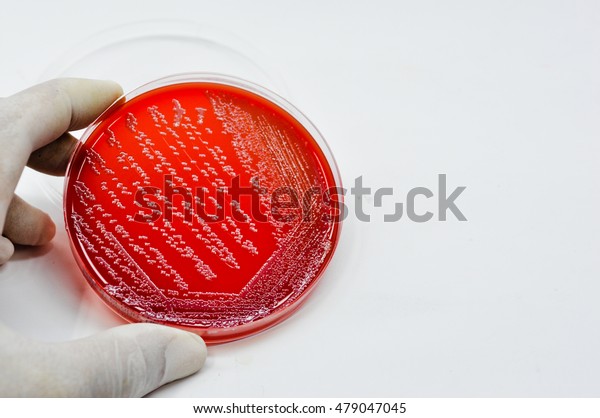 Colonies of White bacteria culture on Blood\
agar plate close up contains small light grains in experimental\
laboratory  Hospital white\
background