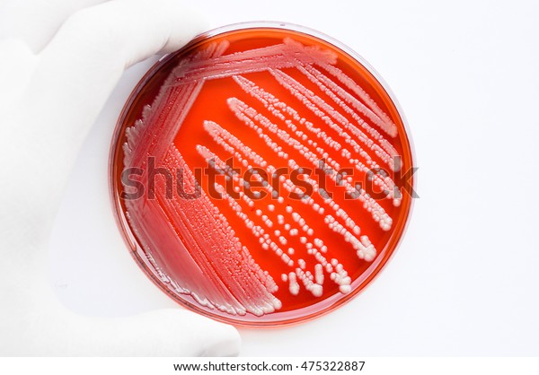 Colonies White Bacteria Gamma Hemolysin Culture Stock Photo (Edit Now