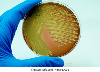 63 Micrococcus culture Images, Stock Photos & Vectors | Shutterstock