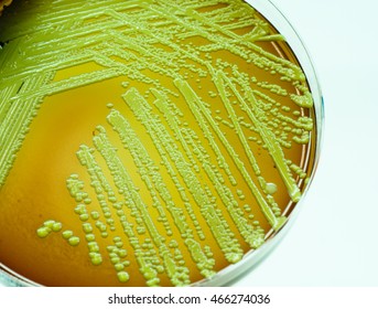 Colonies Yellow Bacteria Micrococcus Luteus Blood Stock Photo 466274036 ...