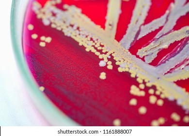 Colony of bacteria in culture medium plate, Microbiology.