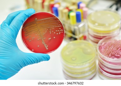 Colony of bacteria in culture medium plate 
