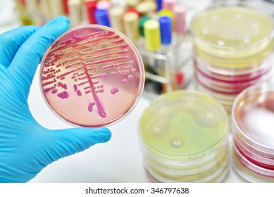 Colony Of Bacteria In Culture Medium Plate 