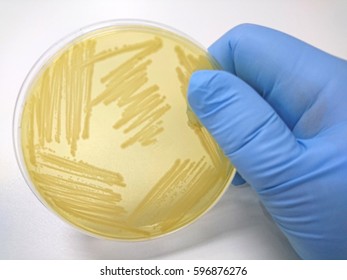 Colony Of Bacteria In Culture Medium Plate, Microbiology.