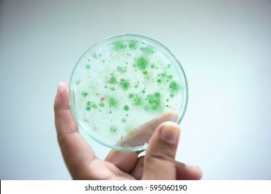 Colony of blue green algae in culture medium plate, Microbiology.