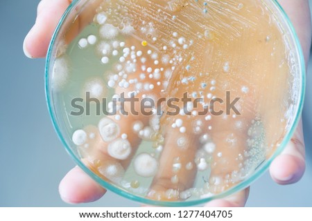 Colony characteristic of Actinomyces, Bacteria, yeast and Mold on selective media from soil samples for study in laboratory microbiology.
