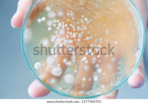 Colony characteristic of Actinomyces,\
Bacteria, yeast and Mold on selective media from soil samples for\
study in laboratory\
microbiology.\
