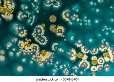 Colony Characteristic Actinomyces On Selective Media Stock Photo ...