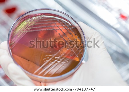 Colony Characteristics of Escherichia coli (E. coli) is a Gram-negative, facultatively anaerobic, rod-shaped, coliform bacterium of the genus Escherichia that is commonly found in the lower intestine 