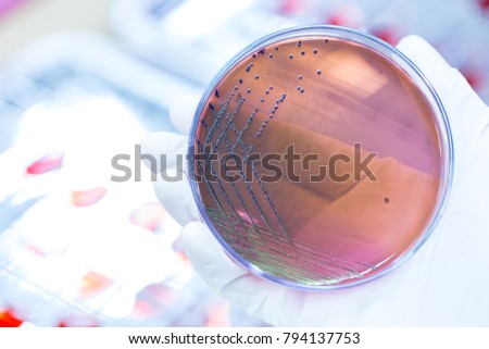 Colony Characteristics of Escherichia coli (E. coli) is a Gram-negative, facultatively anaerobic, rod-shaped, coliform bacterium of the genus Escherichia that is commonly found in the lower intestine 