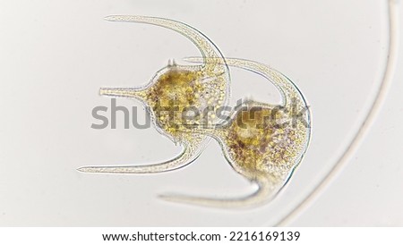 Colony of marine dinoflagellates. The species probably Ceratium humile. Lugol-preserved sample. 400x magnification