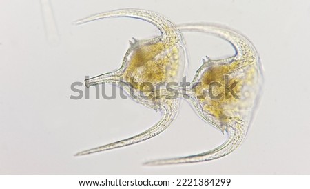 Colony of marine dinoflagellates. The species probably Ceratium humile. 400x magnification with selective focus