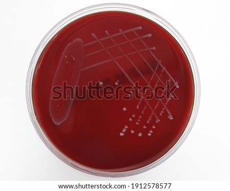 Colony morphology of Enterococcus faecalis on Blood agar