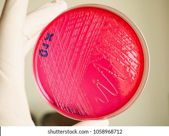 1,666 Shigella Images, Stock Photos & Vectors | Shutterstock