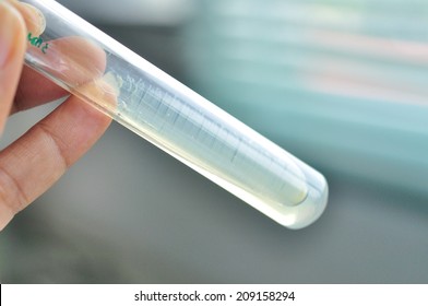 Colony In Slant Agar  