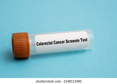 Colorectal Cancer Screenin Test Medical Test In Lab