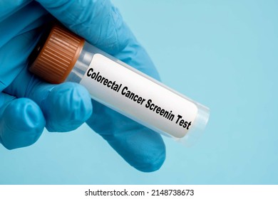 Colorectal Cancer Screenin Test Stool Biological Sample In Medical Science Lab