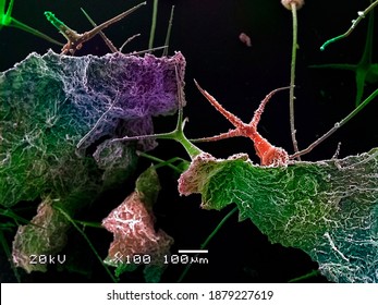 Colored Micrograph Was Taken By Scanning Electron Microscopy.