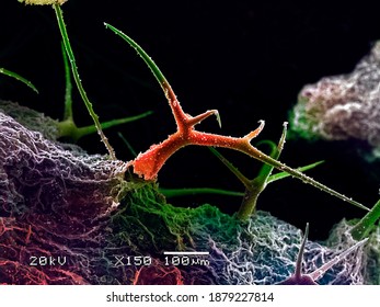 Colored Micrograph Was Taken By Scanning Electron Microscopy.