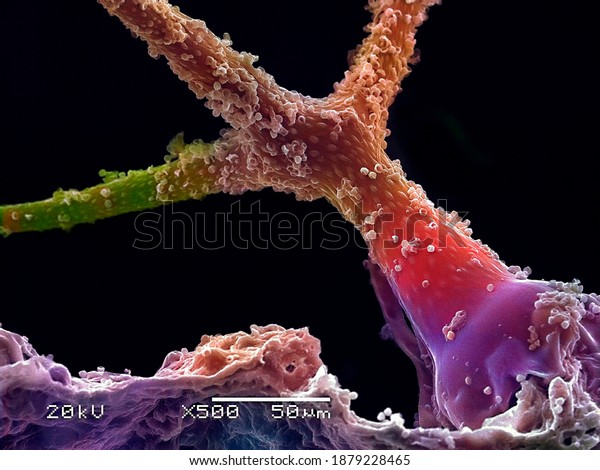 Colored micrograph was taken by scanning\
electron microscopy.