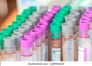 Colorful Blood Tubes In Tray,Colorful Blood Tube Test For Analysis In The Laboratory Of Haematology,spot Focus.