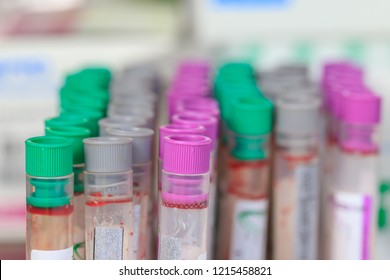 Colorful Blood Tubes In Tray,Colorful Blood Tube Test For Analysis In The Laboratory Of Haematology,spot Focus.