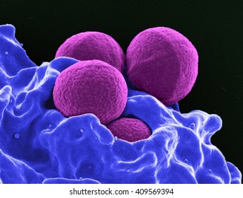 Colorized SEM Of Four Spherical Methicillin-resistant Staphylococcus Aureus (MRSA) Bacteria (purple) In The Process Of Being Phagocytized By A Human Neutrophil White Blood Cell (blue)