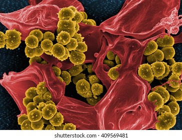 Colorized SEM Of Methicillin-resistant Staphylococcus Aureus (MRSA) Bacteria In The Process Of Being Phagocytized By A Human Neutrophil White Blood Cell