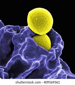 Colorized SEM Of Two Spherical Methicillin-resistant Staphylococcus Aureus (MRSA) Bacteria (yellow) In The Process Of Being Phagocytized By A Human Neutrophil White Blood Cell (blue)