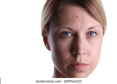 Combination skin problems, dry and oil parts, comedones, wide pores on face - Shutterstock ID 1899563125