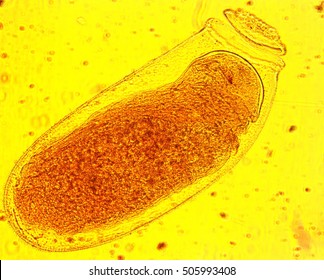 Common bed bug (Cimex lectularius) egg - permanent slide plate under high magnification