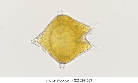 Common Marine Phytoplankton, Protoperidium Sp. Lugol-preserved Sample. 400x Magnification