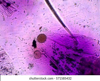 Common Marshmallow Flower Powdered Under Microscope