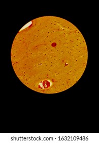 Compact Bone Structure Under Microscope Stock Photo Edit Now 1632109486 Compact Bone Structure Under Microscope Stock Photo Edit Now 1632109486