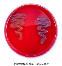 Comparative Bacterial Beta Hemolysis And Non Hemolysis