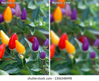 Comparison between normal and myopic views