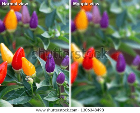 Comparison between normal and myopic views