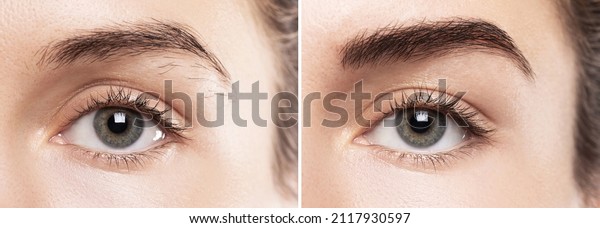 Comparison of female brow after eyebrow shape\
correction  or permanent\
makeup