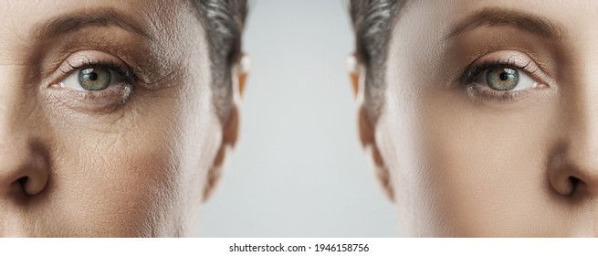 Comparison of female face after incredible rejuvenation process or heavy retouching - Shutterstock ID 1946158756