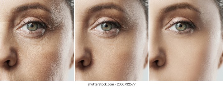 Comparison Of Female Face After Incredible Rejuvenation Process Or Heavy Retouching