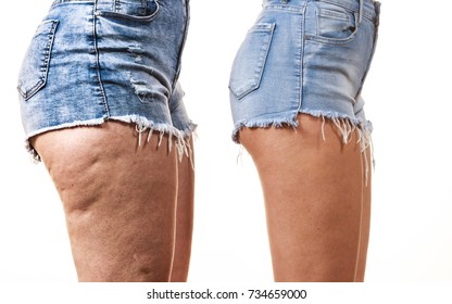 Fat Thighs Stock Photos Images Photography Shutterstock