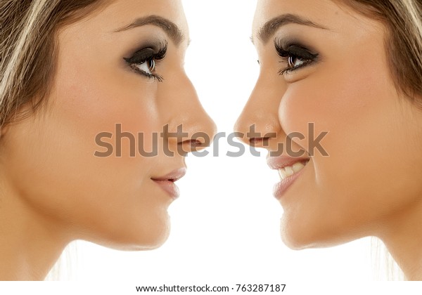 整形前後の女性の鼻の比較 の写真素材 今すぐ編集