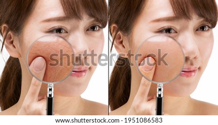 A comparison of female skin magnified with a loupe.