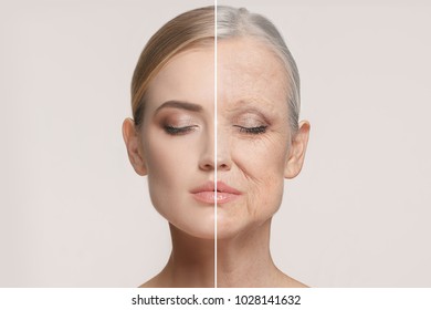Comparison. Portrait of beautiful woman with problem and clean skin, aging and youth concept, beauty treatment and lifting. Before and after concept. Youth, old age. Process of aging and rejuvenation - Shutterstock ID 1028141632