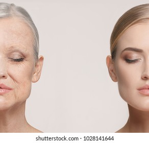 Comparison. Portrait Of Beautiful Woman With Problem And Clean Skin, Aging And Youth Concept, Beauty Treatment And Lifting. Before And After Concept. Youth, Old Age. Process Of Aging And Rejuvenation